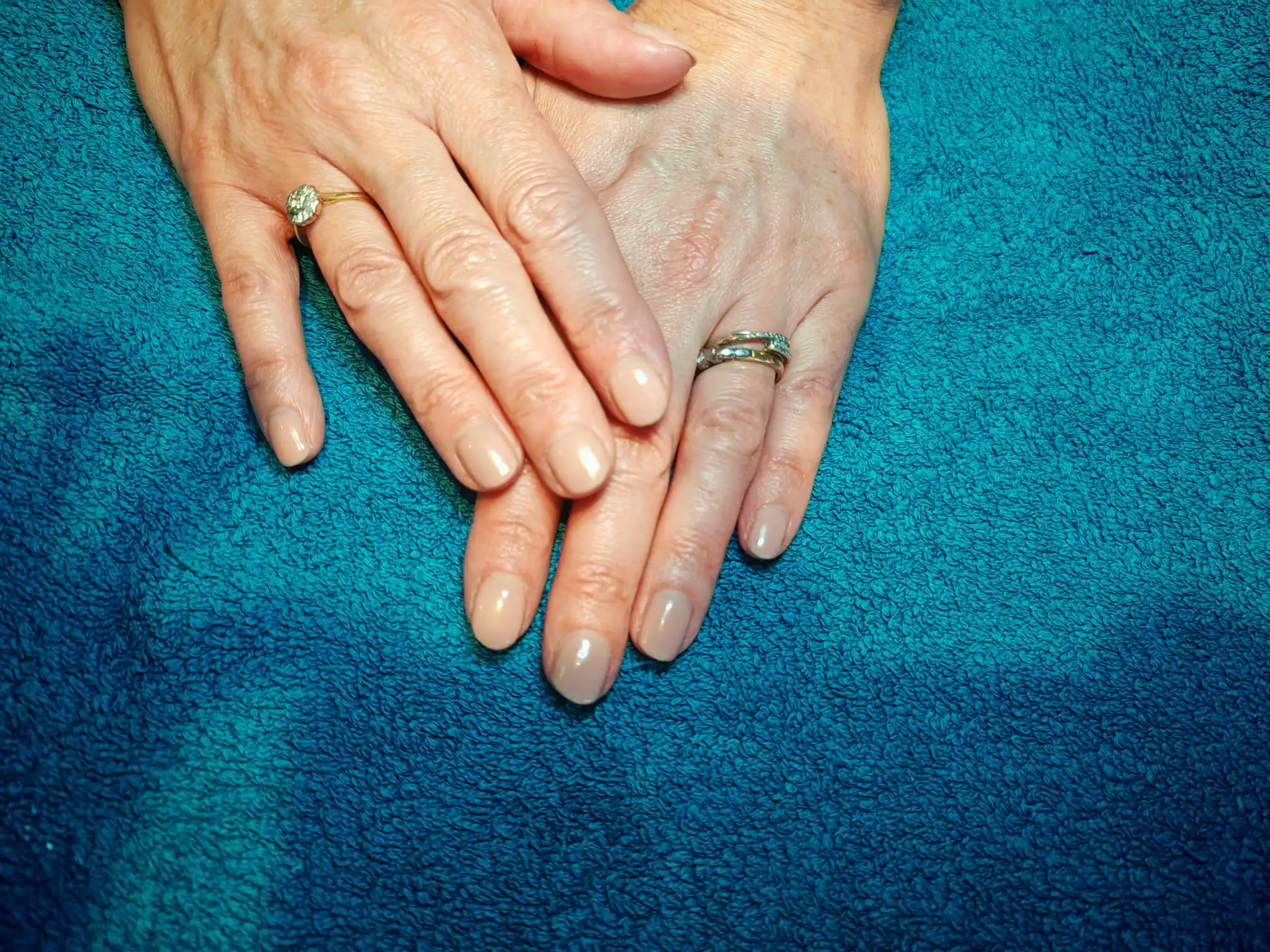 NEW CJP Rubber IT Nail Repair Telford